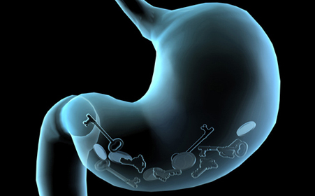 病从口入,肠胃炎就是这么吃出来的